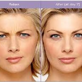 Nirvana Medspa - Physician Administered Botox - Medical Spas Near Me - Terre Haute, Indiana