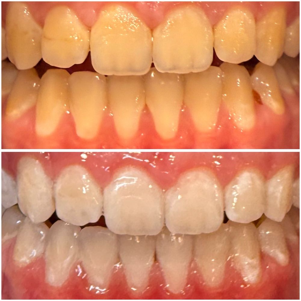 Before & After--all in less than an hour! Before & After--all in less than an hour!