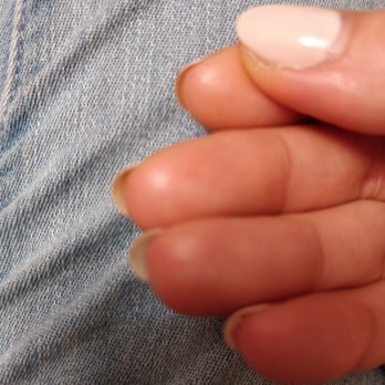Mg Nail & Beauty - The index and the middle finger, both are discoloring and this have never happened to me before while getting gel done somewhere else! - Nail Salons Near Me - Flushing, New York Mg Nail & Beauty - The index and the middle finger, both are discoloring and this have never happened to me before while getting gel done somewhere else! - Nail Salons Near Me - Flushing, New York