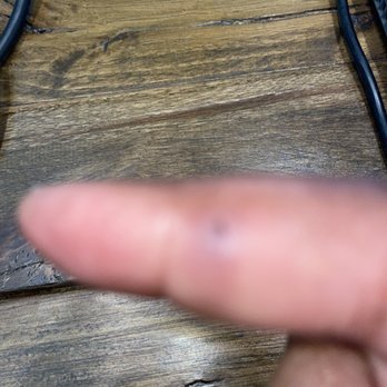 M Design Village - The wood is still Lodged within my hand, swollen and very painful. - Baby Gear & Furniture Near Me - Bedminster, New Jersey