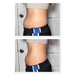 Sculpted Body Contour
