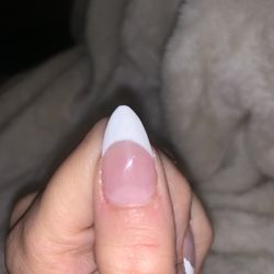Icon Nails - Cut on my cuticle and mid thumb