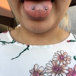 Much better! After getting it repierced! Much better! After getting it repierced!