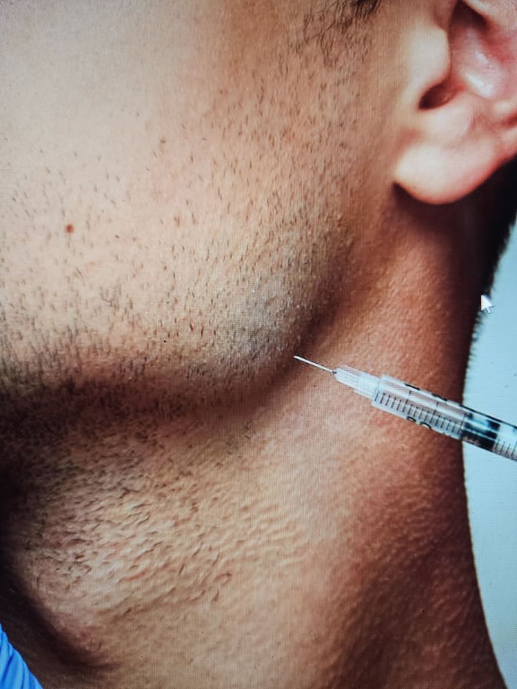 TMJ And Dental Sleep Center of New Jersey - sleep specialist in West New York, NJ