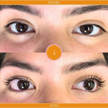 Be Bare Esthetics - .. - Skin Care Near Me - La Mesa, California Be Bare Esthetics - .. - Skin Care Near Me - La Mesa, California
