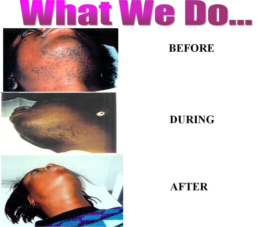 Epilation Clinic Logo