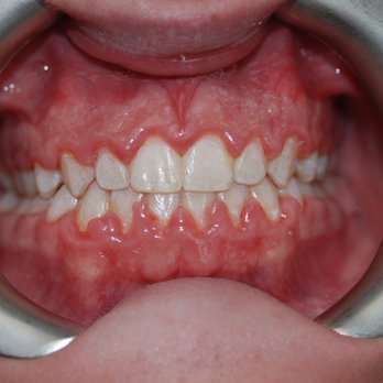 Smileodontics - Orthodontists Near Me - Mason, Ohio Smileodontics - Orthodontists Near Me - Mason, Ohio