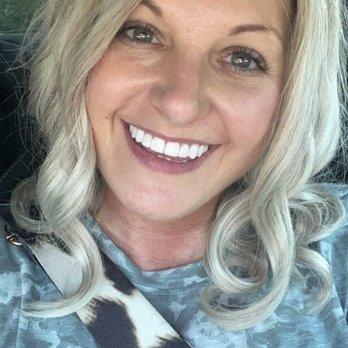 Zachary Johnston, DDS - After - Pediatric Dentists Near Me - Memphis, Tennessee