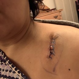 Surgery