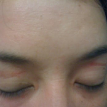 LV Nail & Spa - Burn marks on eyelid - Nail Salons Near Me - Washington, DC, District of Columbia LV Nail & Spa - Burn marks on eyelid - Nail Salons Near Me - Washington, DC, District of Columbia