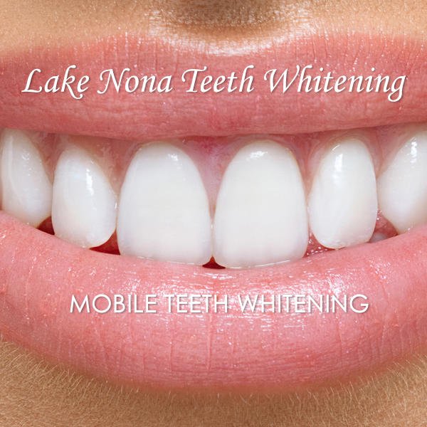Lake Nona Teeth Whitening Logo