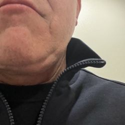 Ali Heidari, DO - Contour Aesthetic Center - This is the 'after' picture of a Heidari neck lift.