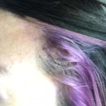 Belleza Salon - The result: color at the temple; uneven - Hair Salons Near Me - Knoxville, Tennessee
