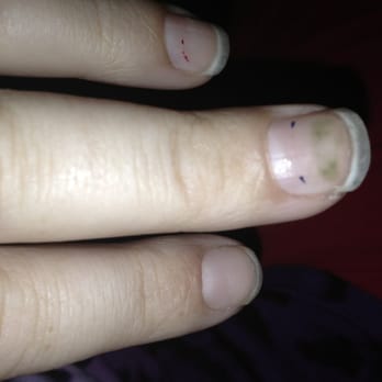 Q-Nails - Fungi I got from here. - Nail Salons Near Me - Inglewood, California Q-Nails - Fungi I got from here. - Nail Salons Near Me - Inglewood, California