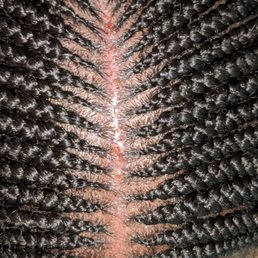 Braids done too tight Braids done too tight