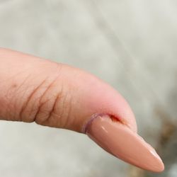 JP Nails & Spa - It's been three days and my cuticle still hurts and is bleeding on occasion.