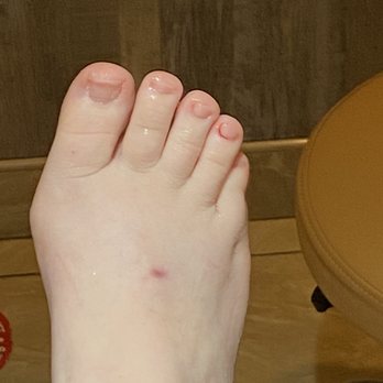 Serenity Nails & Spa - Bleeding toe. - Massage Near Me - Glen Burnie, Maryland Serenity Nails & Spa - Bleeding toe. - Massage Near Me - Glen Burnie, Maryland
