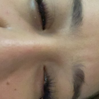 Lash Daddy - Crusted eyes shut after 2 rounds of coconut oil - Eyelash Service Near Me - Las Vegas, Nevada Lash Daddy - Crusted eyes shut after 2 rounds of coconut oil - Eyelash Service Near Me - Las Vegas, Nevada
