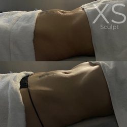 XS Sculpt - Customized XSCURVES treatment. Why customized? Because every body is different. We specialize in providing results.