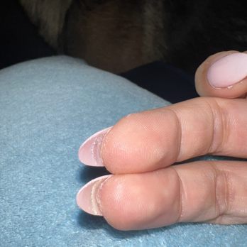 Today Nails and Spa - Finger full of super glue under he didn't even remove the old nail he just filed over it and put another on top - Nail Salons Near Me - Hesperia, California Today Nails and Spa - Finger full of super glue under he didn't even remove the old nail he just filed over it and put another on top - Nail Salons Near Me - Hesperia, California