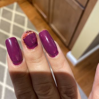 Lucky Nails - Before - Nail Salons Near Me - Springfield, Virginia