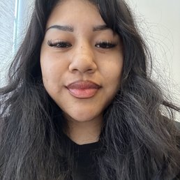 Wisdom teeth removal