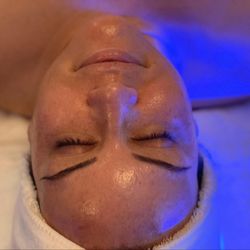 Nu Yu Laser Hair Removal - Love that glow following a HydraFacial!