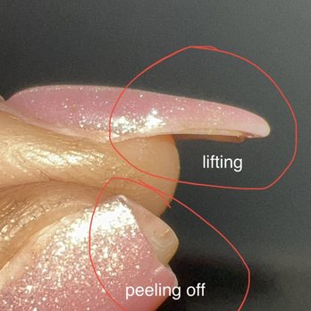 Njoy Nails Spa - all my nails are like lifting up or peeling off my nails :/ - Waxing Near Me - Morgan Hill, California Njoy Nails Spa - all my nails are like lifting up or peeling off my nails :/ - Waxing Near Me - Morgan Hill, California