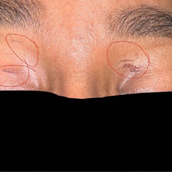 La Threading & Beauty Salon - 2 days after - Eyelash Service Near Me - Bell, California La Threading & Beauty Salon - 2 days after - Eyelash Service Near Me - Bell, California