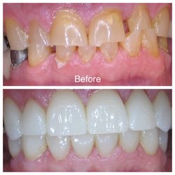 Nilay Nanavati, DDS