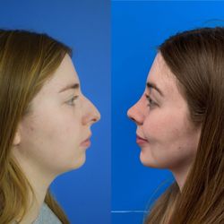 NJ ENT and Facial Plastic Surgery