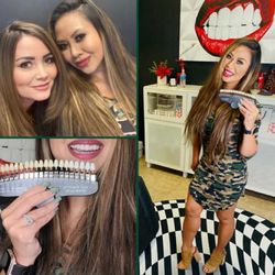 Lip Lab Az - Happy Client who is obsessed with keeping her teeth whiten.