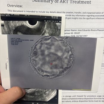 Life IVF Center - Fertility Near Me - Irvine, California Life IVF Center - Fertility Near Me - Irvine, California