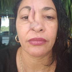 Reyes Blas A MD PA - Reina reyes pacientes de islas Caimán