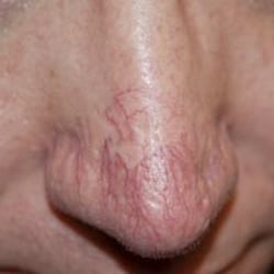 Softouch Permanent Makeup
