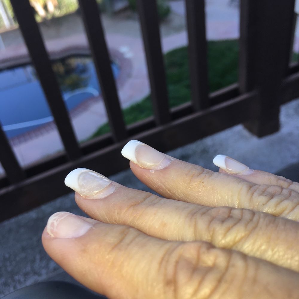 Ivy's Nails & Spa - Nails lifting because the nail salon insisted acrylics were better than gel or SNS dip - Nail Salons Near Me - Temecula, California Ivy's Nails & Spa - Nails lifting because the nail salon insisted acrylics were better than gel or SNS dip - Nail Salons Near Me - Temecula, California