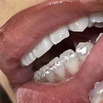Boujee Face & Body - Teeth Whitening Near Me Boujee Face & Body - Teeth Whitening Near Me