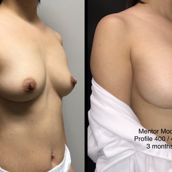Jude LaBarbera, MD  - Mesa - Plastic Surgeons Near Me - Mesa, Arizona