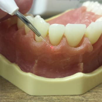 Herman Salzberg, DMD - DENTAL LASER - General Dentistry Near Me - Palatine, Illinois Herman Salzberg, DMD - DENTAL LASER - General Dentistry Near Me - Palatine, Illinois