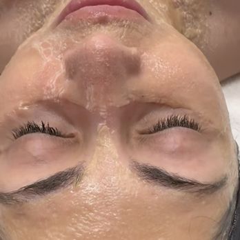 Skin Republic - Skin Care Near Me - Santa Clara, California Skin Republic - Skin Care Near Me - Santa Clara, California