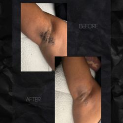 Lashed By Lynn - Underarm Wax $35 for both arms!