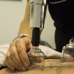 Embody Neighborhood Wellness - We also provide a Cupping Massage, which can help with inflammation, blood flow and relaxation.