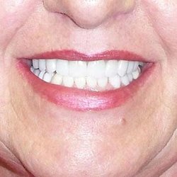 Young Family and Cosmetic Dentistry