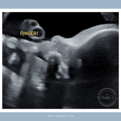 The 3D Baby Co. - Baby showing off a cute 2D profile while chewing on some fingers... yumm!