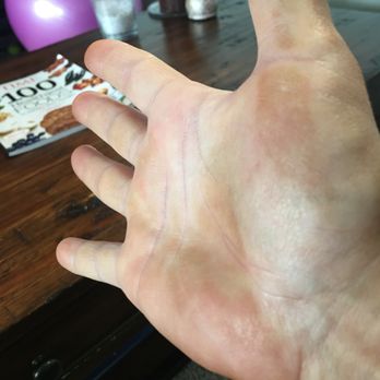 Sinless Sun Spray Tanning - Streaky hands - Spray Tanning Near Me - Denver, Colorado Sinless Sun Spray Tanning - Streaky hands - Spray Tanning Near Me - Denver, Colorado