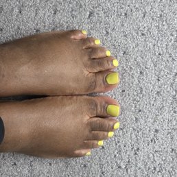 Yellow Toes Yellow Toes
