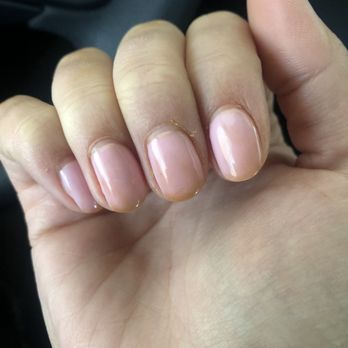 Xpressions Salon - Nasty ass yellowing at the tips of my finger nails...and no, I'm not a dirty person. - Hair Salons Near Me - Boise, Idaho Xpressions Salon - Nasty ass yellowing at the tips of my finger nails...and no, I'm not a dirty person. - Hair Salons Near Me - Boise, Idaho