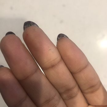 Garden Nail & Spa - Gunk under nail from soak off. - Nail Salons Near Me - Brooklyn, New York