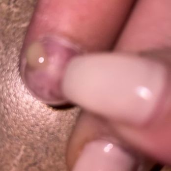 Linda's Nails - Nails fungus - Nail Salons Near Me - Mobile, Alabama