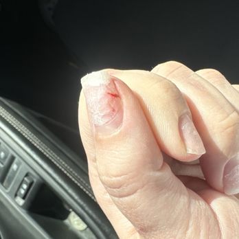 NQ Nails - So damaged! Bleeding under the nail and ripped from the skin! - Nail Salons Near Me - Clinton Township, Michigan